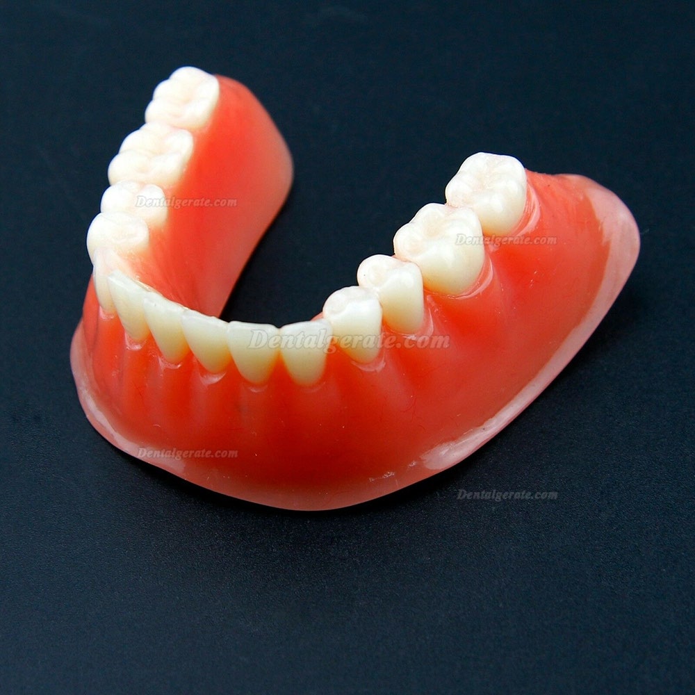 Dental Overdenture Typodont Modell Minderwertiges Pr&auml;zisionsimplantat Golden 6009